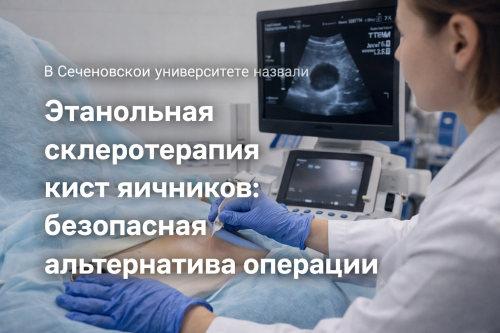 Ученые Сеченовского университета предложили способ лечения кист яичников без операции